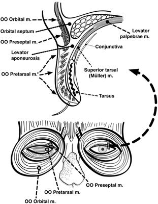 Eyelid Dysfunction in Neurodegenerative, Neurogenetic, and Neurometabolic Disease